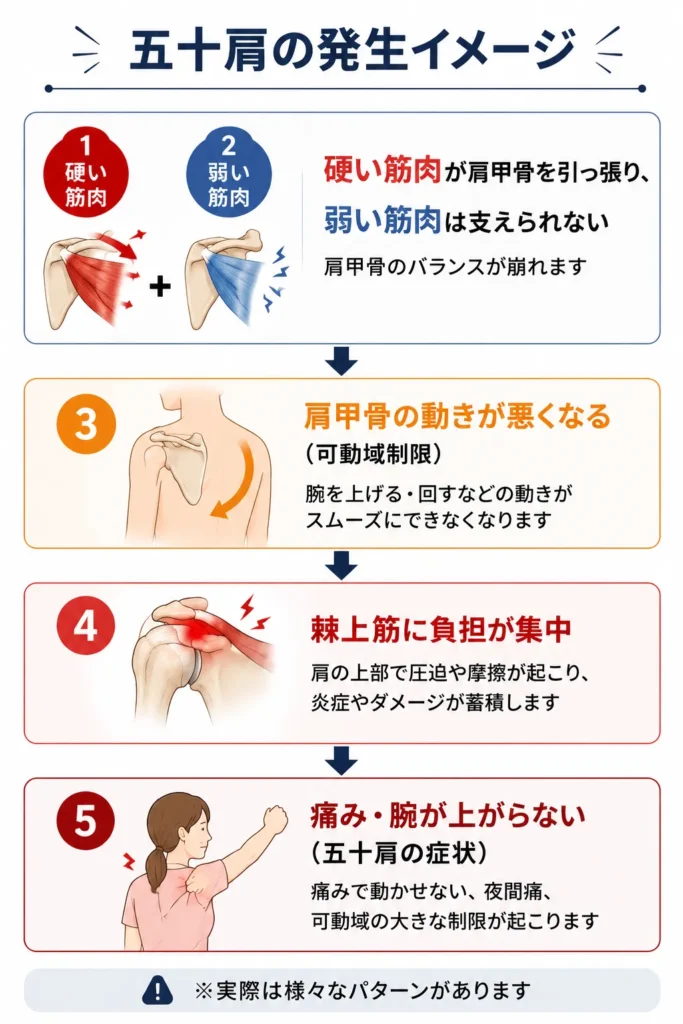 五十肩の発生機序