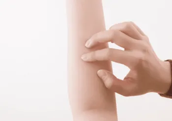 腕の障害